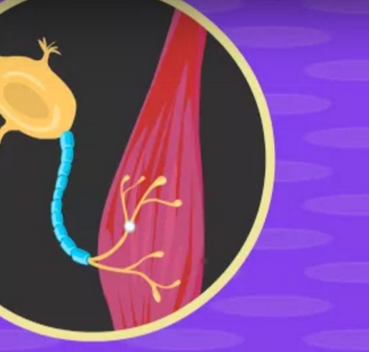 Motor Neurone Disease